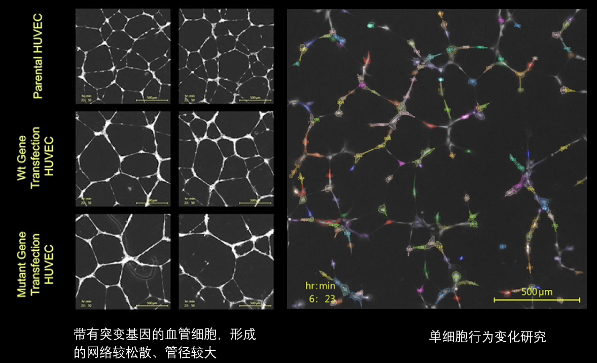 6、血管分析.png