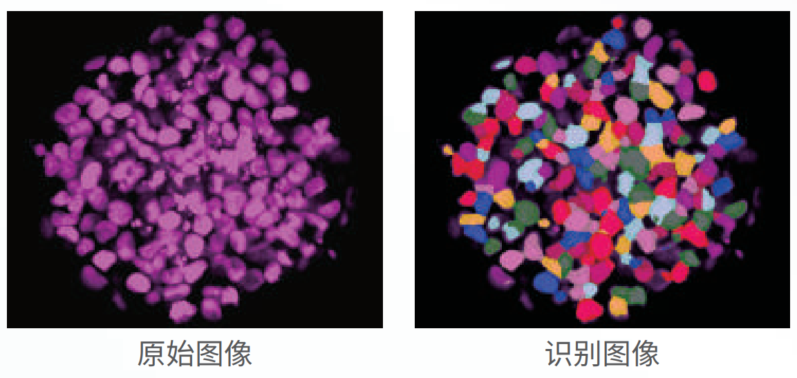 應(yīng)用3：類器官、球體成像.png